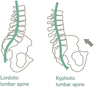 se_supporting_the_spine_when_seated_fig5